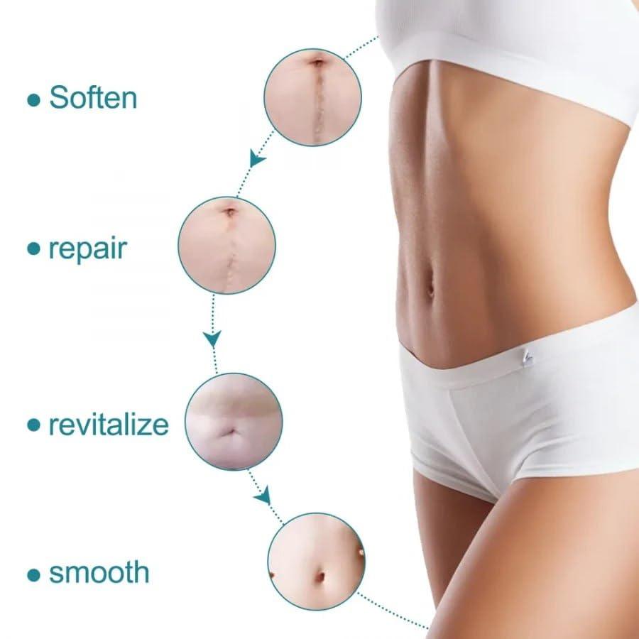 Silicone Scars Removal Sheets