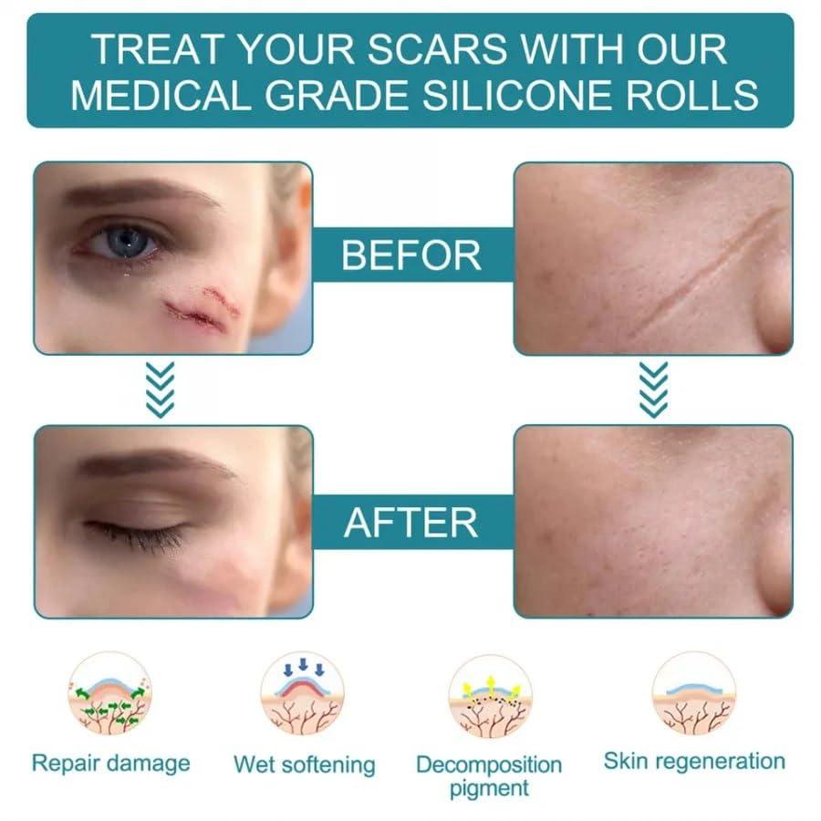 Silicone Scars Removal Sheets