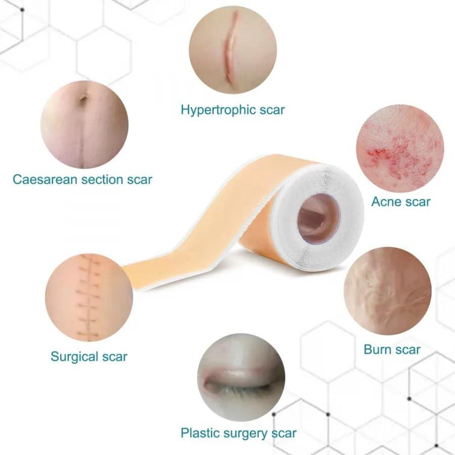 Silicone Scars Removal Sheets